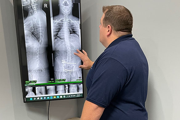 Chiropractor Summerville TX Michael McIntyre X-Ray Review